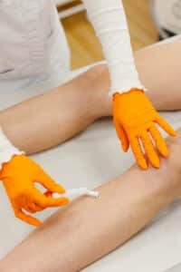 Epilazione laser o tradizionale