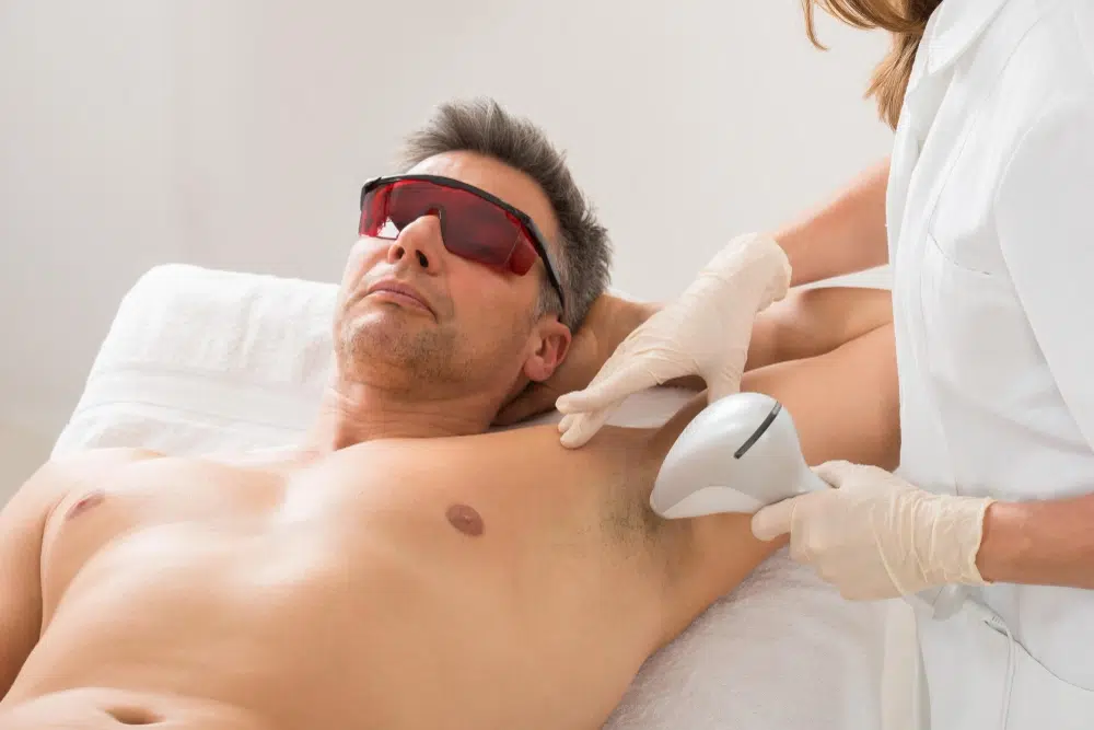 Quante sedute di epilazione laser sono necessarie prima dell'estate?